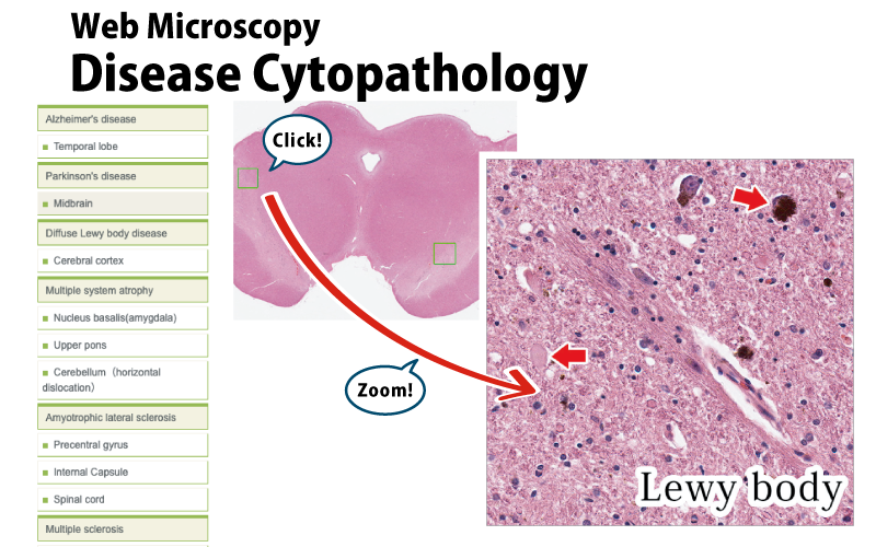 Disease Cytopathology