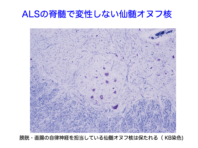 即納人気 すべてがわかるＡＬＳ・運動ニューロン疾患 / 辻 省次 総編集