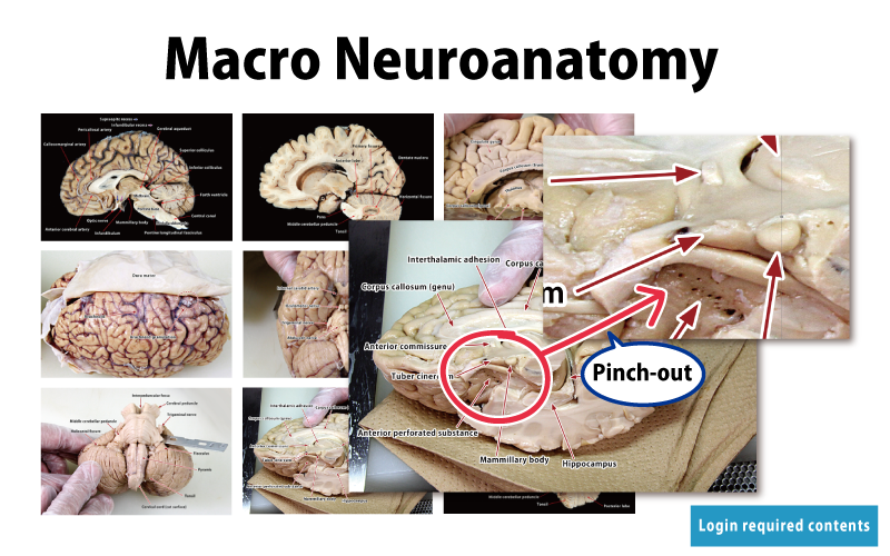 Macro Neuroanatomy