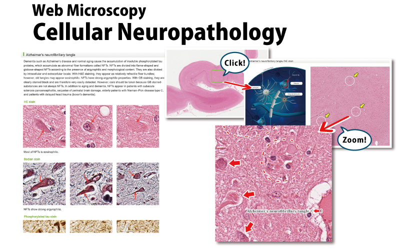 Cellular Neuropathology