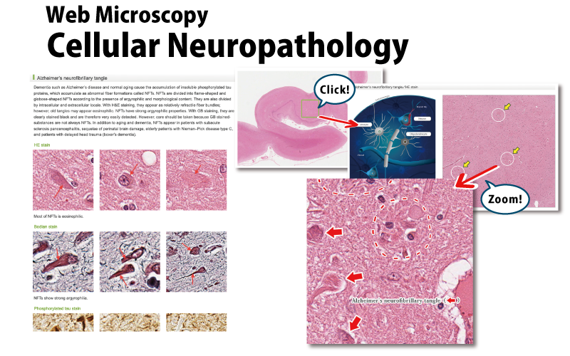 Cellular Neuropathology