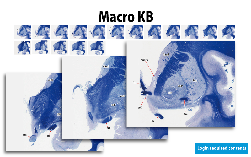 KB Neuroanatomy 