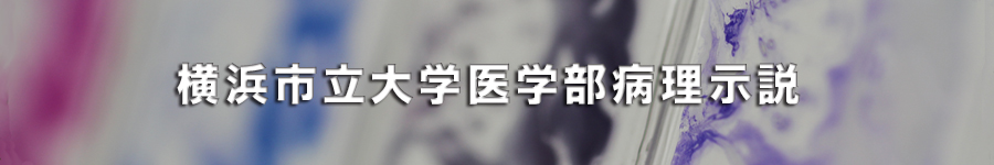 ycu